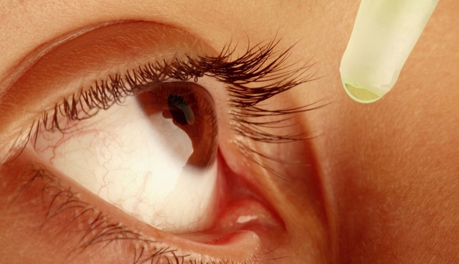First Aid for Eye Problems
