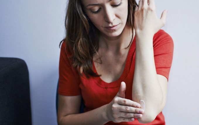 woman applying cream on elbow